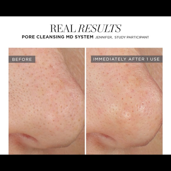 Rodan + Fields Pore Cleansing MD System - Picture 4 of 4